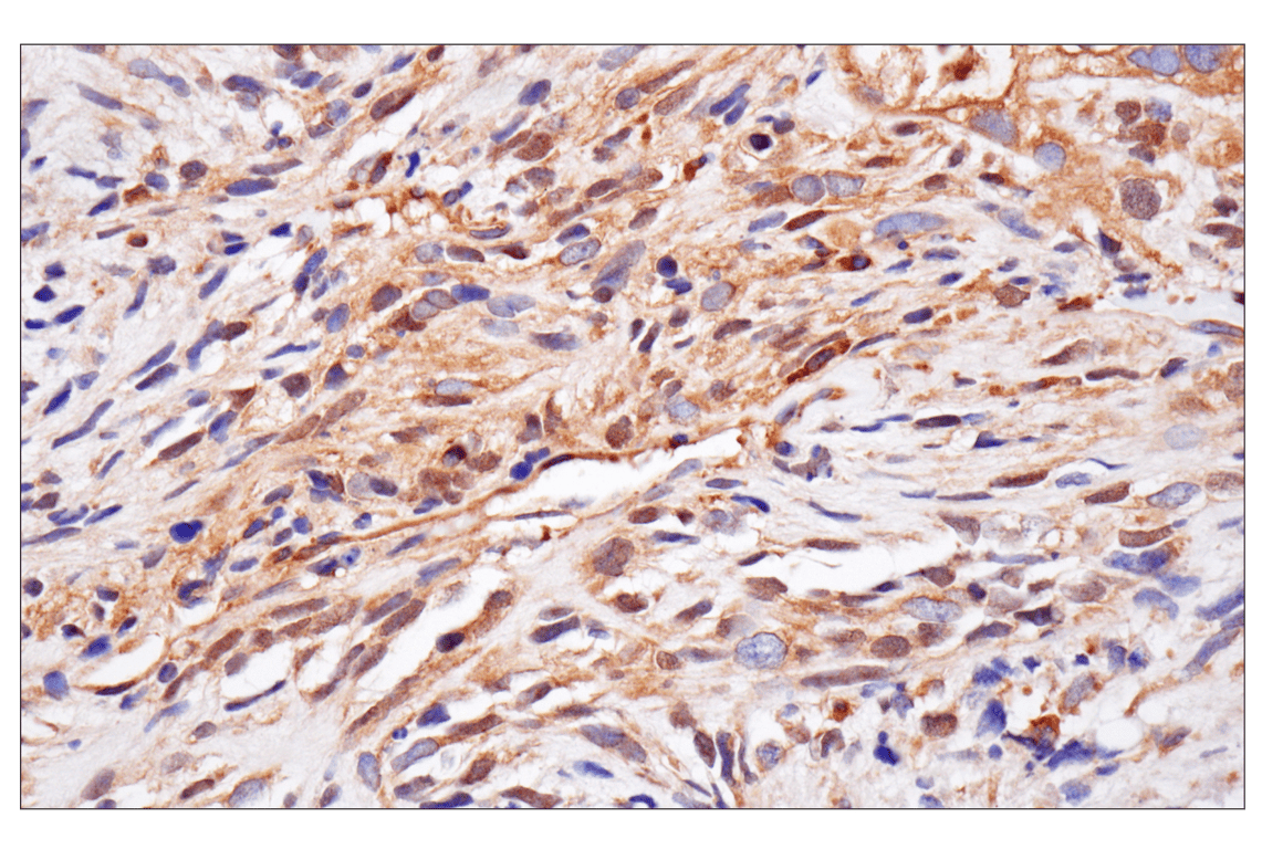 Immunohistochemistry Image 5: NF-kappaB p65 (D14E12) Rabbit Monoclonal Antibody (BSA and Azide Free)