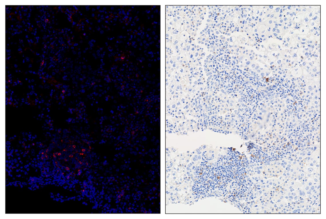 Immunohistochemistry Image 5: PD-1 (Intracellular Domain) (D4W2J) & CO-0008-488 SignalStar<sup>™</sup> Oligo-Antibody Pair