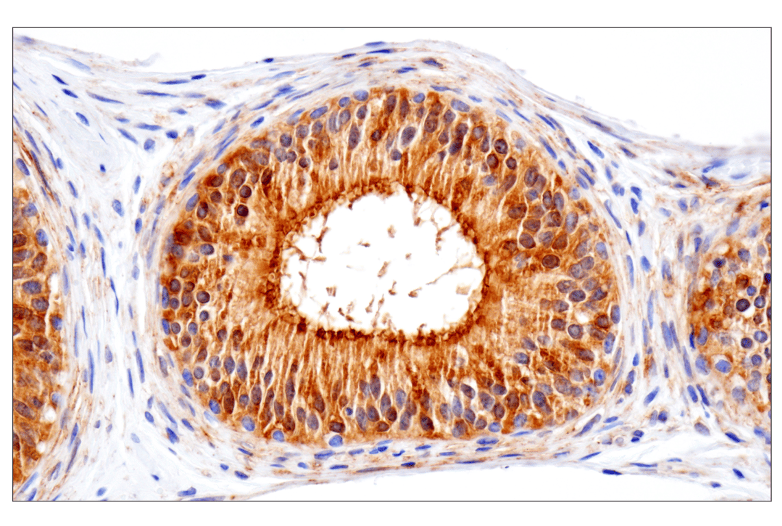 Immunohistochemistry Image 3: Angiomotin (F7W8U) Rabbit Monoclonal Antibody