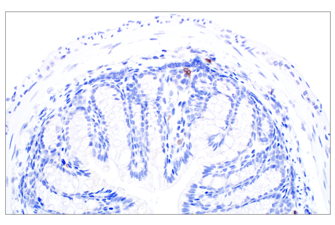 Immunohistochemistry Image 6: NCR1/NKp46 (F8M2L) Rabbit Monoclonal Antibody (IHC Formulated)