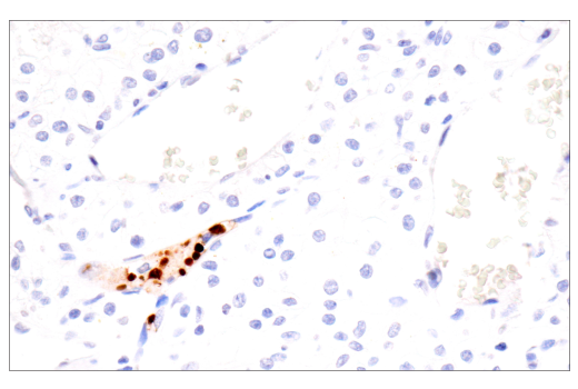 undefined Image 19: NETosis Antibody Sampler Kit