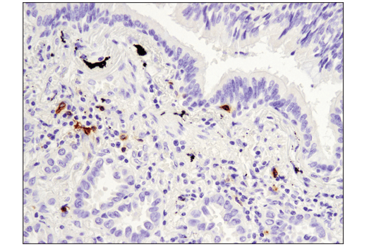 Immunohistochemistry Image 3: OX40 (E9U7O) XP<sup>®</sup> Rabbit mAb