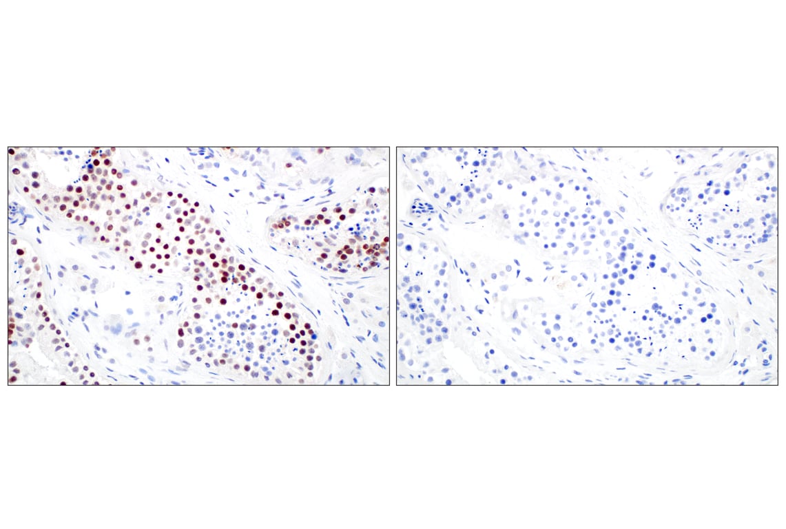 Immunohistochemistry Image 7: Menin (E5P1R) Rabbit Monoclonal Antibody
