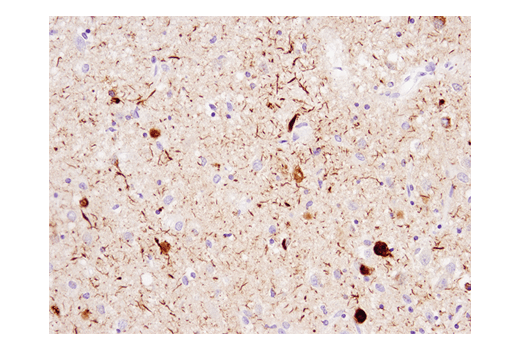 Immunohistochemistry Image 1: Phospho-Tau (Ser404) (D2Z4G) Rabbit Monoclonal Antibody (IHC/IF Formulated)