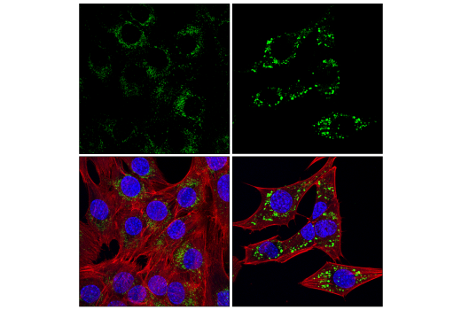 LAMP1 (E5N9Z) Rabbit mAb (Alexa Fluor® 488 Conjugate) | Cell
