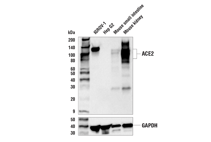 Western Blotting Image 1: ACE2 (E9G3S) Mouse mAb