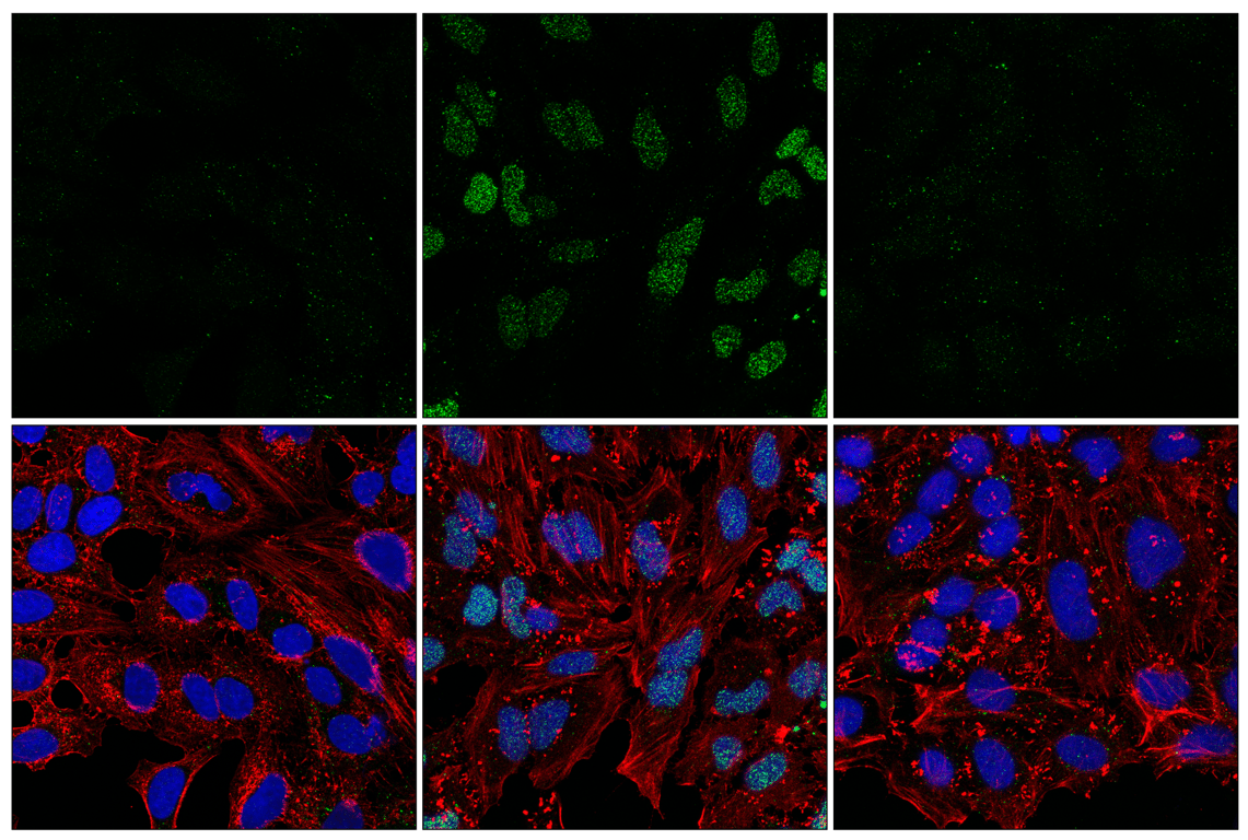 Immunofluorescence Image 1: Poly/Mono-ADP Ribose (D9P7Z) Rabbit mAb