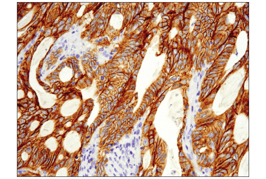 Immunohistochemistry Image 1: Met (D1C2) Rabbit Monoclonal Antibody (BSA and Azide Free)