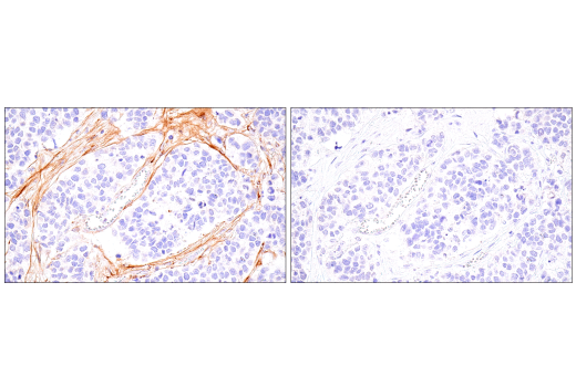 Immunohistochemistry Image 3: COL5A1 (E6U9W) Rabbit Monoclonal Antibody (BSA and Azide Free)