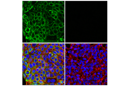 Immunofluorescence Image 1: Pan-Keratin (AE1/AE3) Mouse Monoclonal Antibody