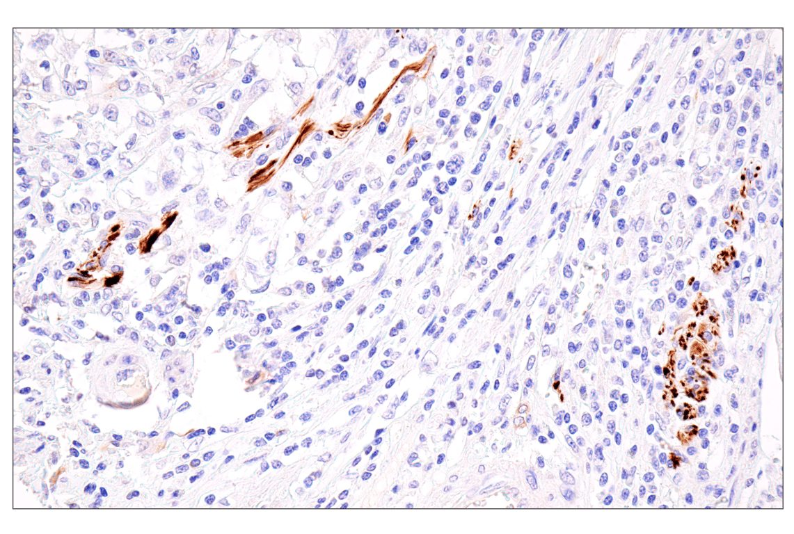 Immunohistochemistry Image 2: Neurofilament-M (E7L2T) Rabbit Monoclonal Antibody (BSA and Azide Free)