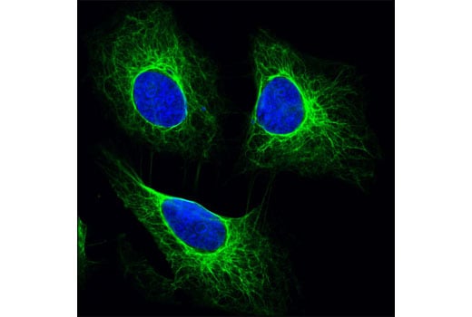 Immunofluorescence Image 1: Pan-Keratin (C11) Mouse Monoclonal Antibody
