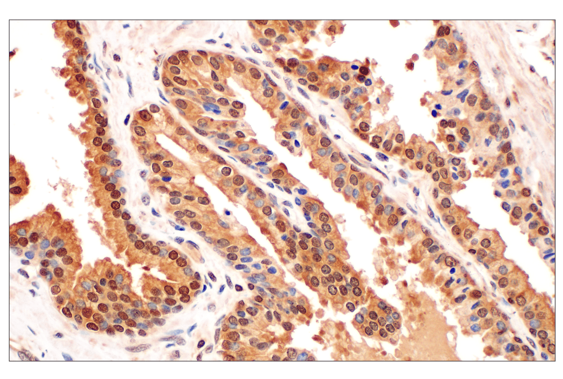 Immunohistochemistry Image 2: MTAP (E5R1I) Rabbit Monoclonal Antibody