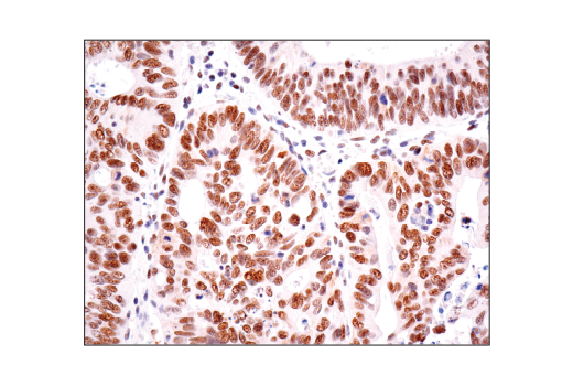 Immunohistochemistry Image 1: HAUSP (D17C6) Rabbit Monoclonal Antibody