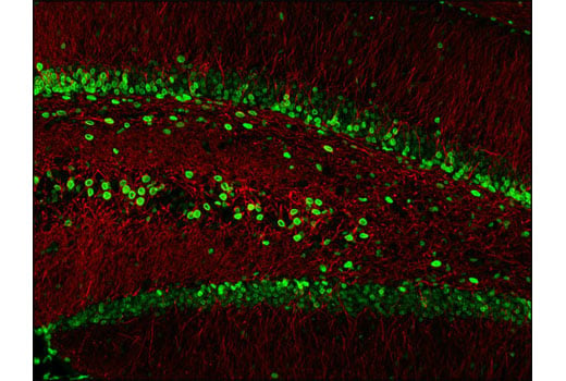 Immunofluorescence Image 1: Lamin A/C (4C11) Mouse Monoclonal Antibody