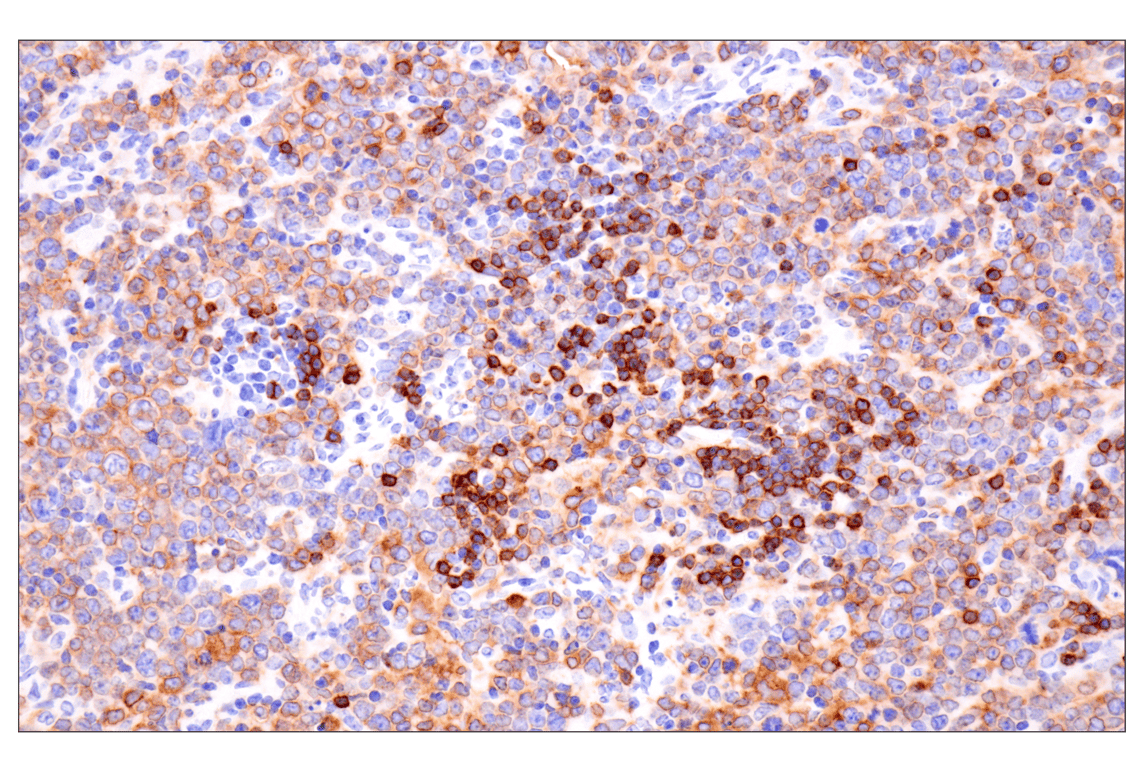 Immunohistochemistry Image 1: CD79A (F3Z1H) Rabbit Monoclonal Antibody
