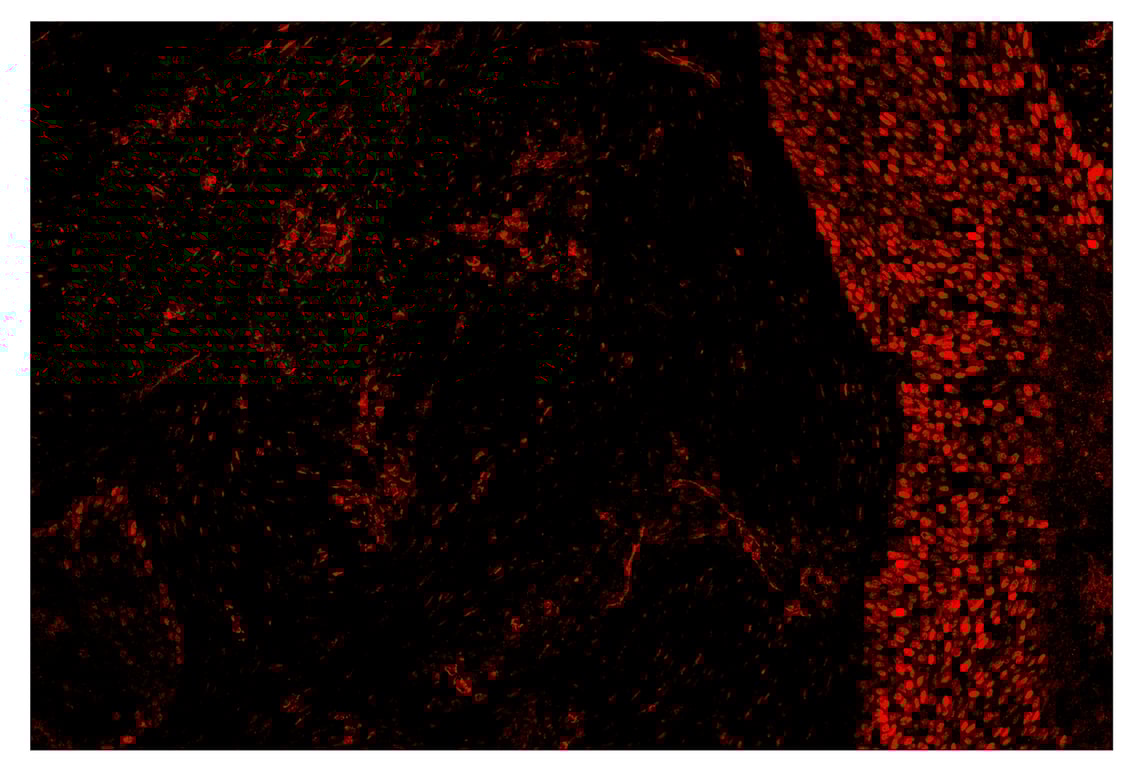 Immunohistochemistry Image 4: Phospho-Stat3 (Tyr705) (D3A7) & CO-0029-488 SignalStar<sup>™</sup> Oligo-Antibody Pair