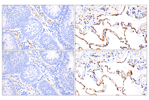 Immunohistochemistry Image 6: VE-Cadherin (E6N7A) Rabbit Monoclonal Antibody