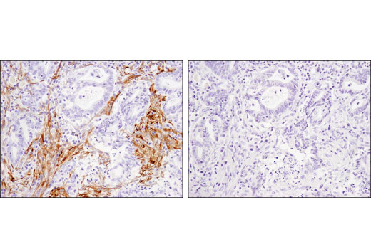 Immunohistochemistry Image 3: Calponin 1 (D8L2T) Rabbit Monoclonal Antibody