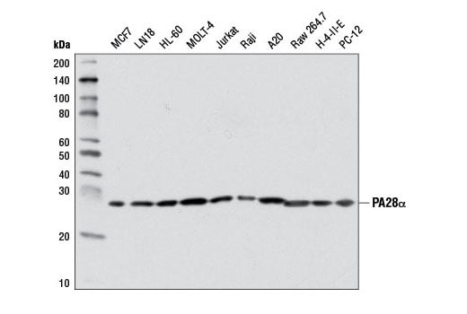 Western Blotting Image 2: PA28 alpha (D4F12) Rabbit Monoclonal Antibody