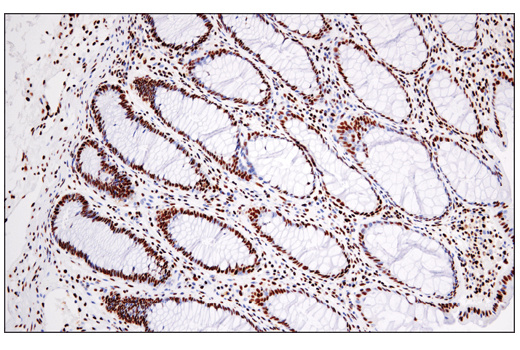 Immunohistochemistry Image 2: DNA-PKcs (E6U3A) Rabbit Monoclonal Antibody (BSA and Azide Free)