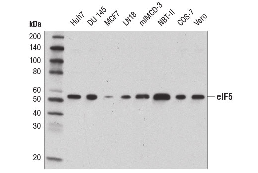 Western Blotting Image 1: eIF5 (D5G9) Rabbit mAb