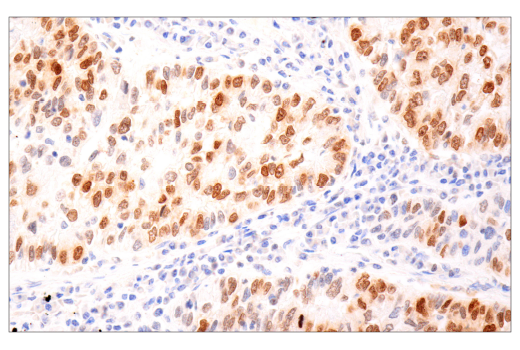 Immunohistochemistry Image 1: Phospho-Histone H2A.X (Ser139) (D7T2V) Mouse Monoclonal Antibody