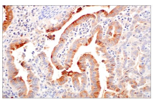 Immunohistochemistry Image 1: LCN2 (D4M8L) Rabbit Monoclonal Antibody