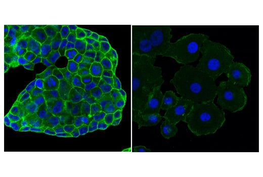 Immunofluorescence Image 1: Ras (E4K9L) Rabbit Monoclonal Antibody (BSA and Azide Free)