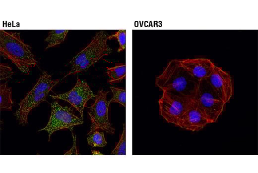 Immunofluorescence Image 1: Dab2 (D7O9T) Rabbit Monoclonal Antibody