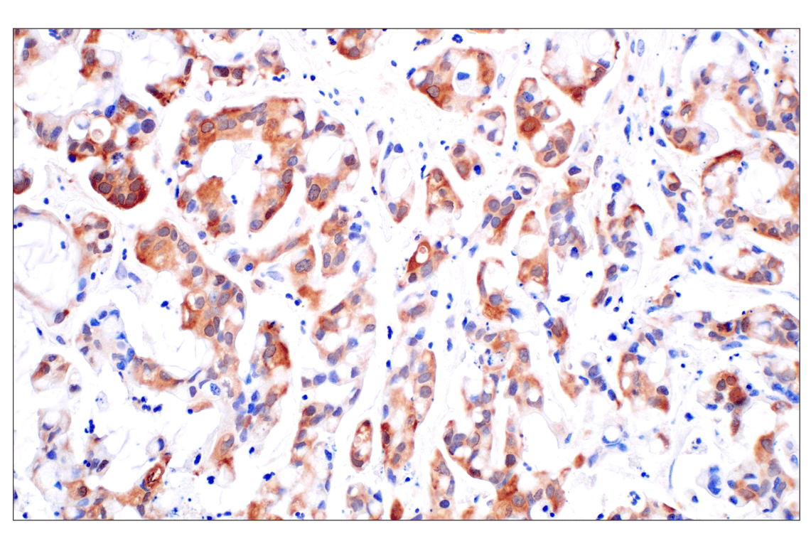 Immunohistochemistry Image 3: PIP4K2C (E7P3S) Rabbit Monoclonal Antibody (BSA and Azide Free)