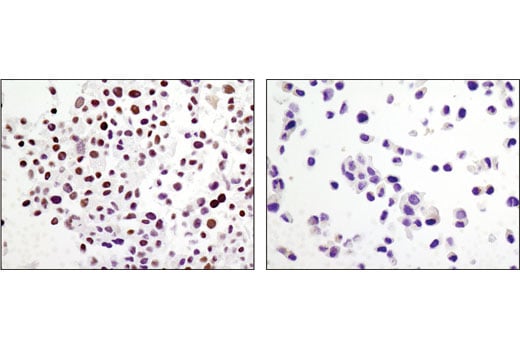 undefined Image 31: BAF Complex Antibody Sampler Kit