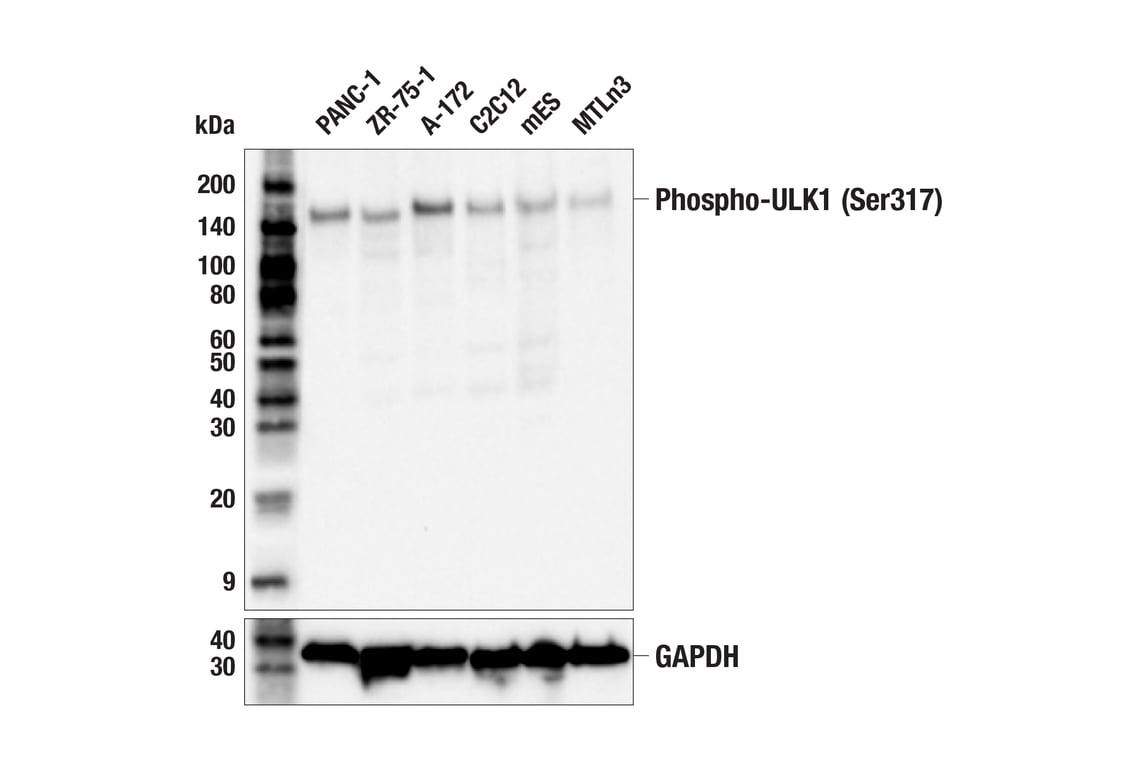 Western Blotting Image 4: Phospho-ULK1 (Ser317) (F1Z6C) Rabbit Monoclonal Antibody