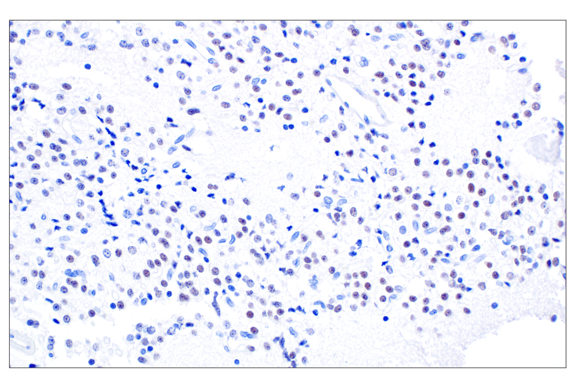 Immunohistochemistry Image 1: SIX3 (F1I1S) Rabbit Monoclonal Antibody