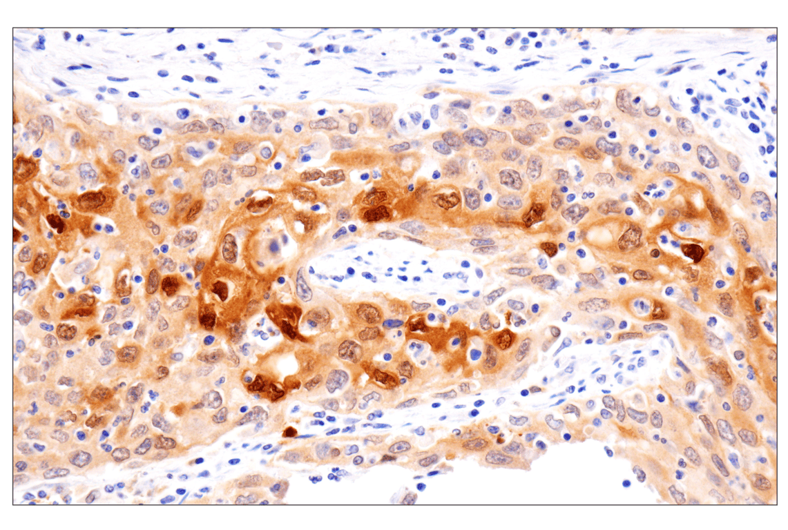 Immunohistochemistry Image 2: APOBEC3A (UMN-13) Rabbit Monoclonal Antibody