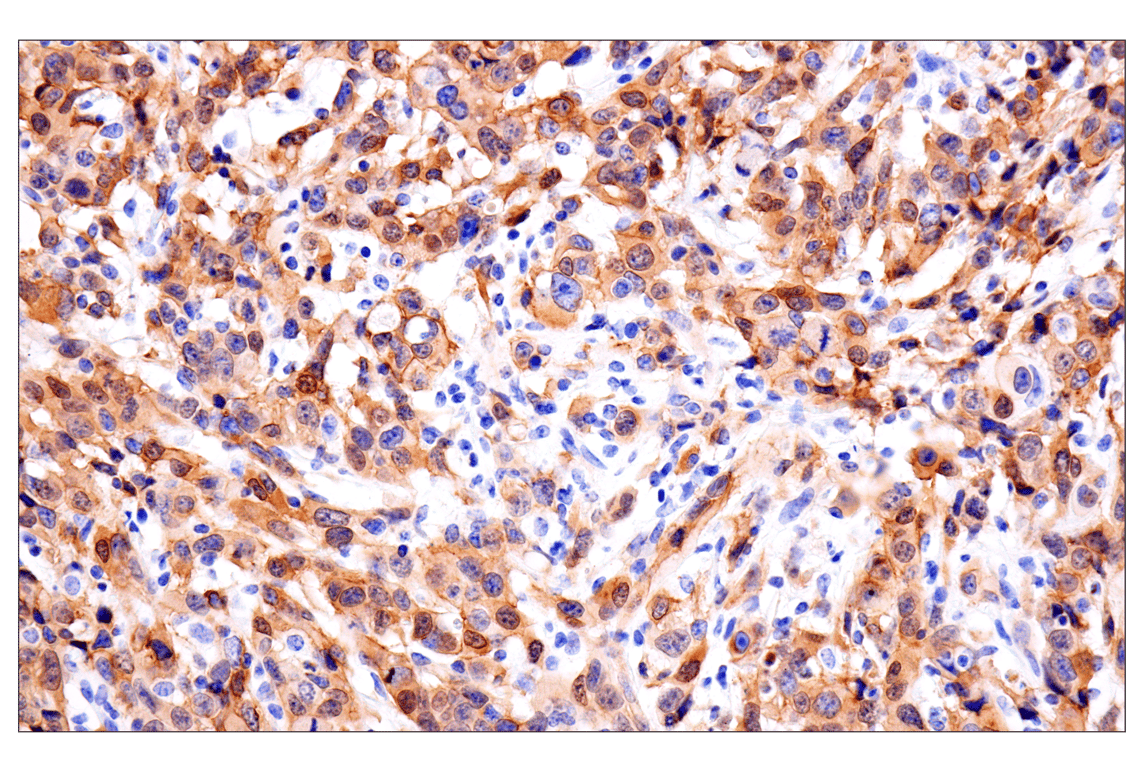 Immunohistochemistry Image 3: Olig1 (E3T6D) Rabbit Monoclonal Antibody