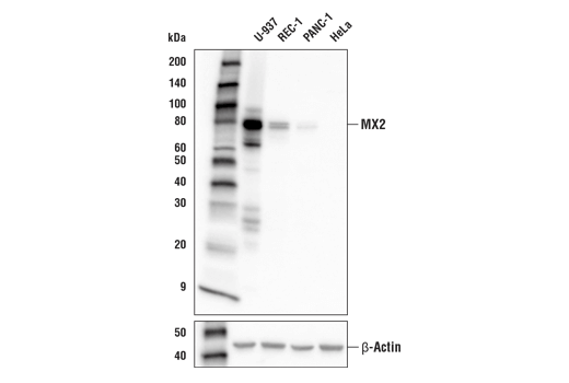 Western Blotting Image 2: MX2 (E7Y8H) Rabbit Monoclonal Antibody