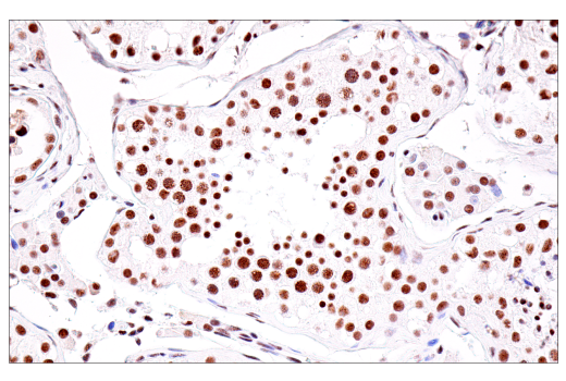 Immunohistochemistry Image 8: USP39 (E8U2M) Rabbit Monoclonal Antibody