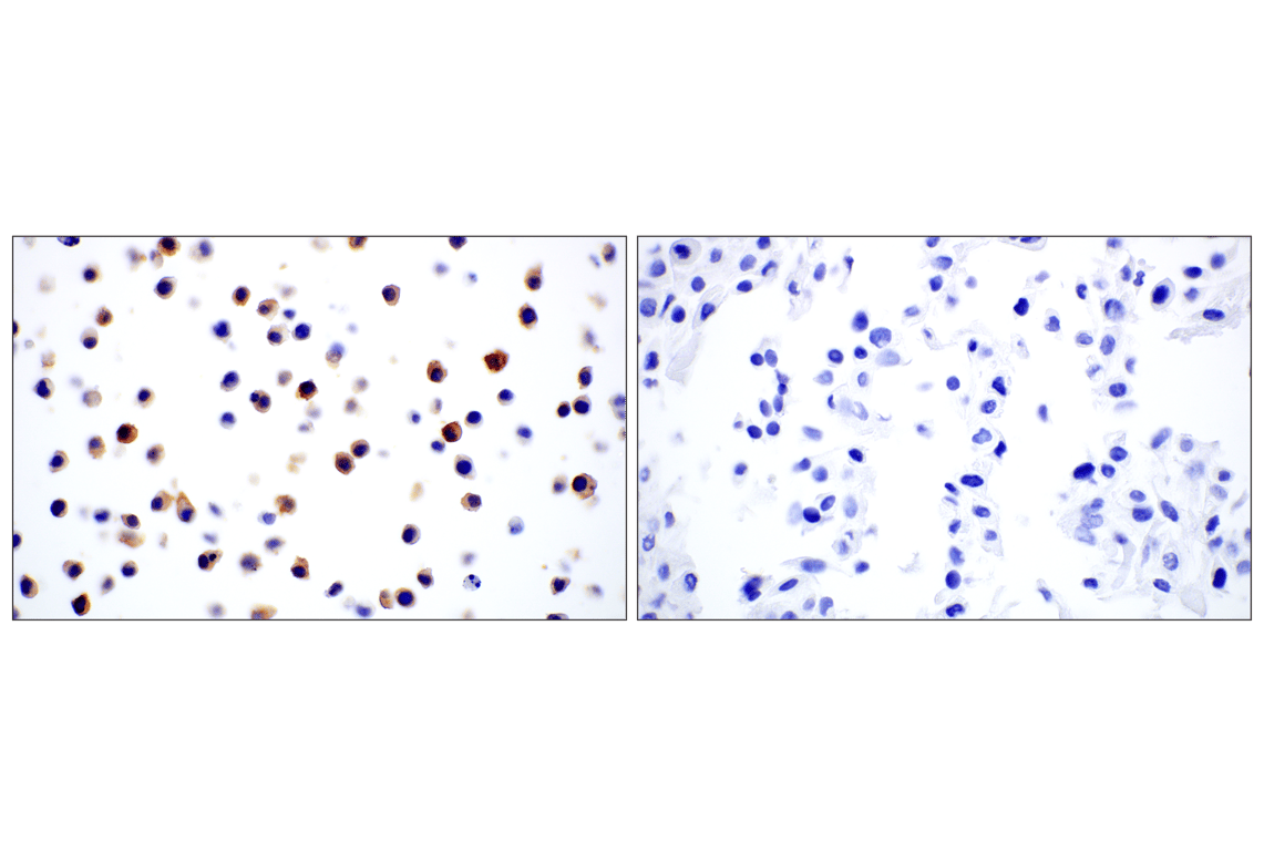 Immunohistochemistry Image 7: Dectin-1/ Clec7a (E3P5W) Rabbit Monoclonal Antibody (BSA and Azide Free)