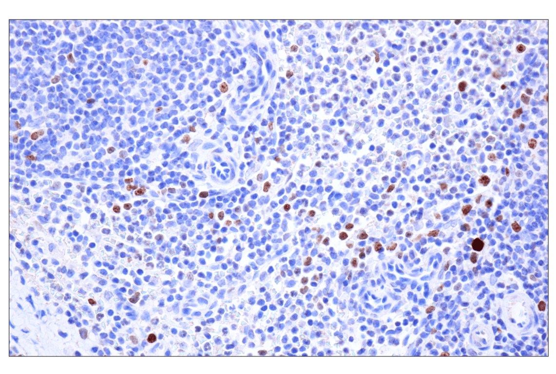 Immunohistochemistry Image 4: Ki-67 (8D5) Mouse Monoclonal Antibody (BSA and Azide Free)