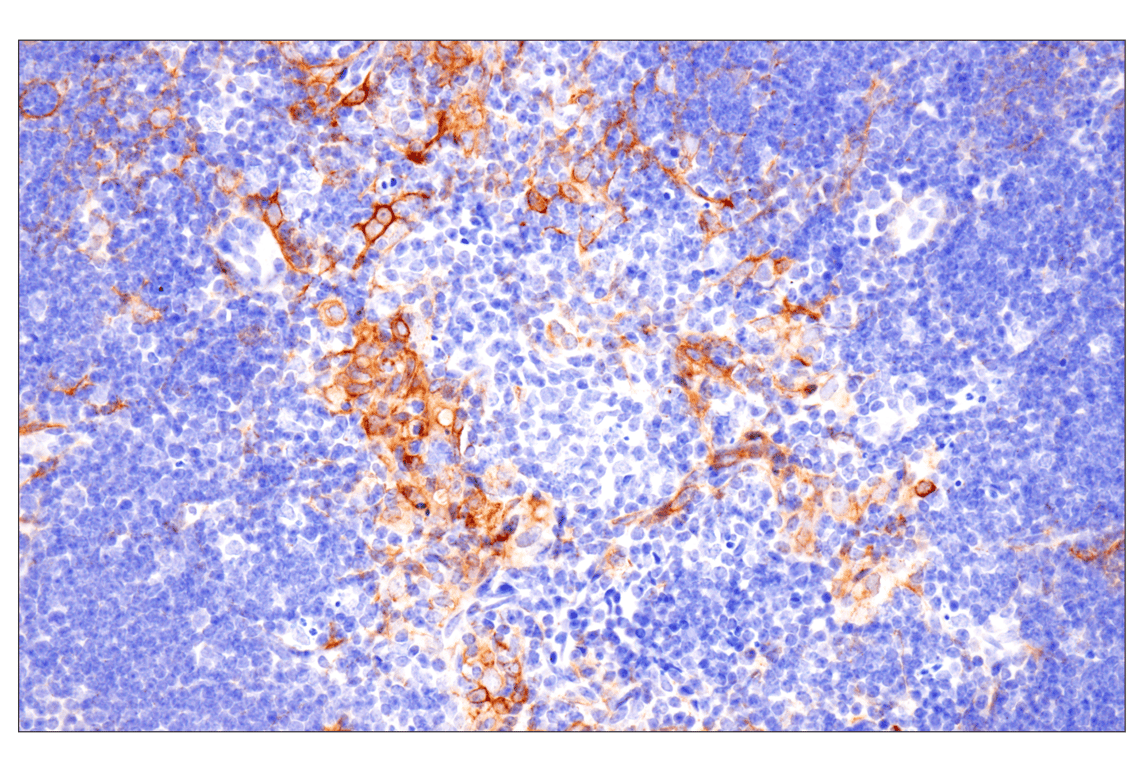 Immunohistochemistry Image 16: Pan-Keratin (Type II) (F6G1P) Rabbit Monoclonal Antibody