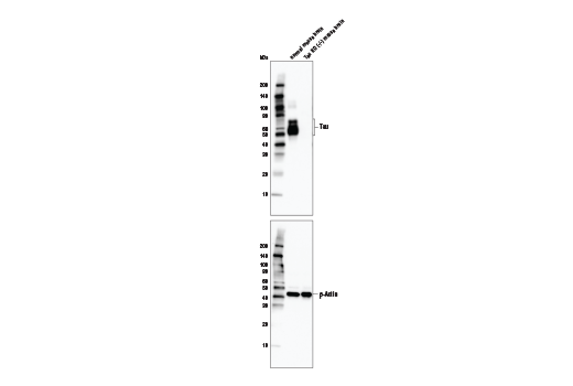 undefined Image 1: PhosphoPlus<sup>®</sup> Tau (Ser396) Antibody Duet