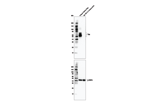 undefined Image 7: Pathological Hallmarks of Alzheimer's Disease Antibody Sampler Kit