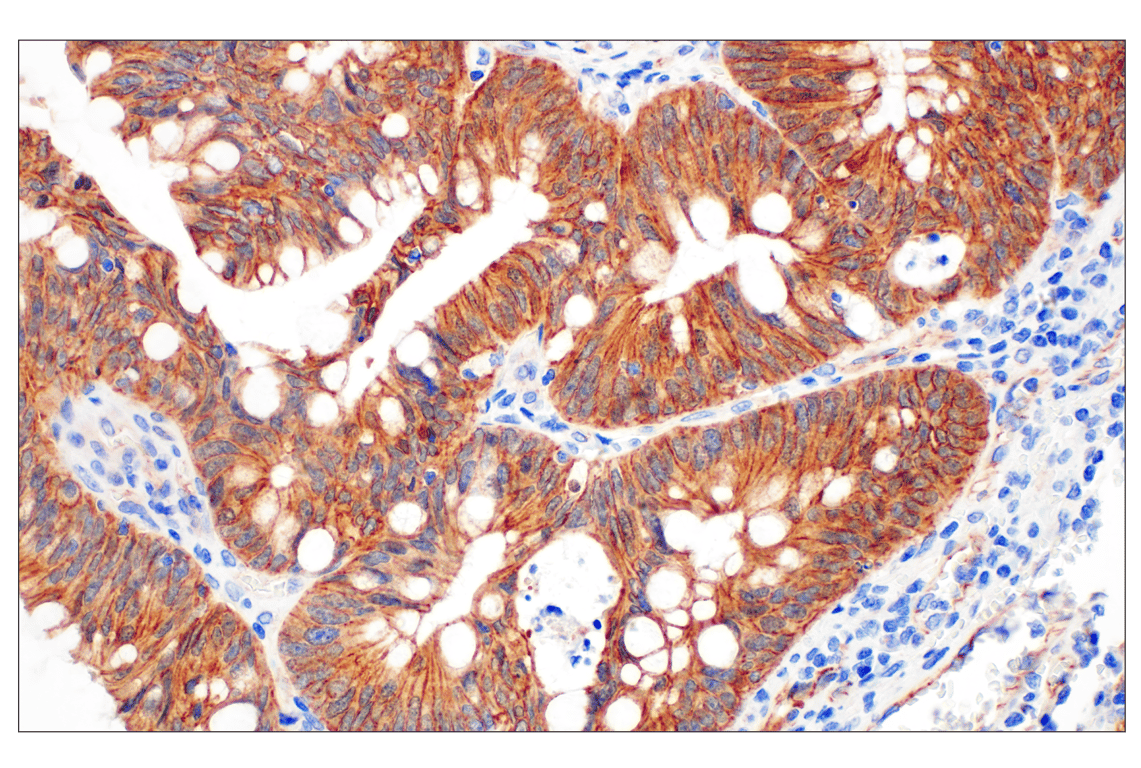 Immunohistochemistry Image 2: beta-Catenin (D10A8) Rabbit Monoclonal Antibody (BSA and Azide Free)