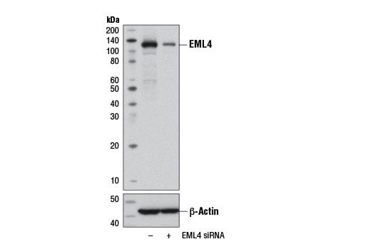 Western Blotting Image 2: EML4 (D7Y8F) Rabbit Monoclonal Antibody