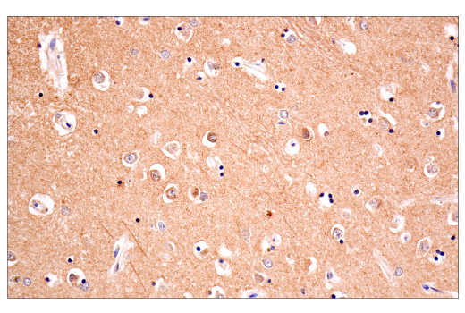 Immunohistochemistry Image 5: Phospho-Tau (Thr205) (E3E3B) Mouse Monoclonal Antibody