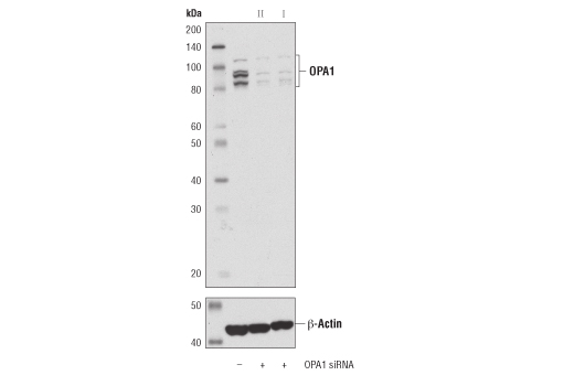 Western Blotting Image 2: OPA1 (D7C1A) Rabbit Monoclonal Antibody
