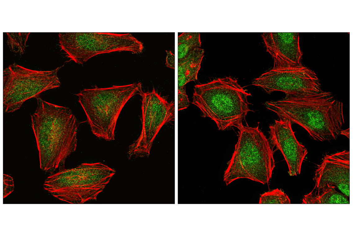 Immunofluorescence Image 1: Phospho-SAPK/JNK (Thr183/Tyr185) (G9) Mouse Monoclonal Antibody (BSA and Azide Free)