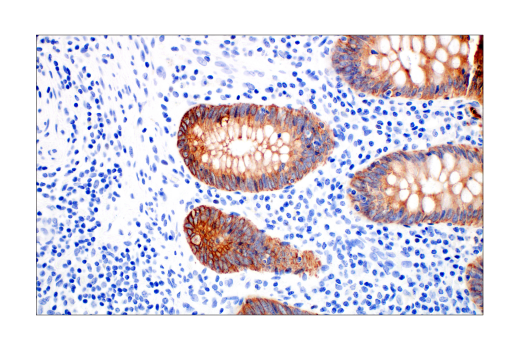 Immunohistochemistry Image 1: Pan-Keratin (AE1/AE3) Mouse mAb