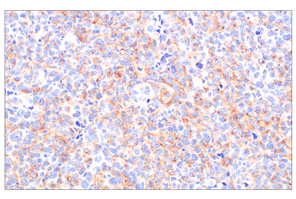 Immunohistochemistry Image 7: TMEM106B (E7H7Z) Rabbit Monoclonal Antibody